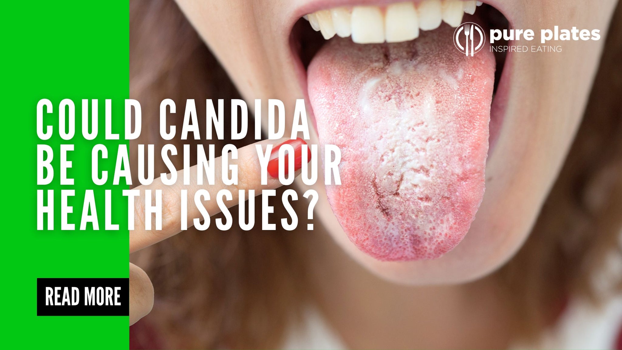 Could Candida Be Causing Your Health Issues?